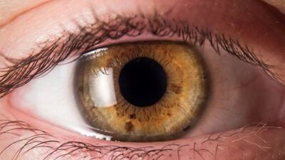 7 علامات في العين قد تدل على الإصابة بالسرطان