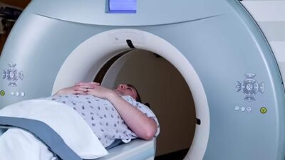 دراسة صادمة تكشف… الـ CT Scan تزيد من خطر الإصابة بالسرطان وهذه التفاصيل!