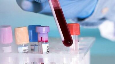 اختبار دم بسيط قد يكشف عن 12 نوعا من السرطان
